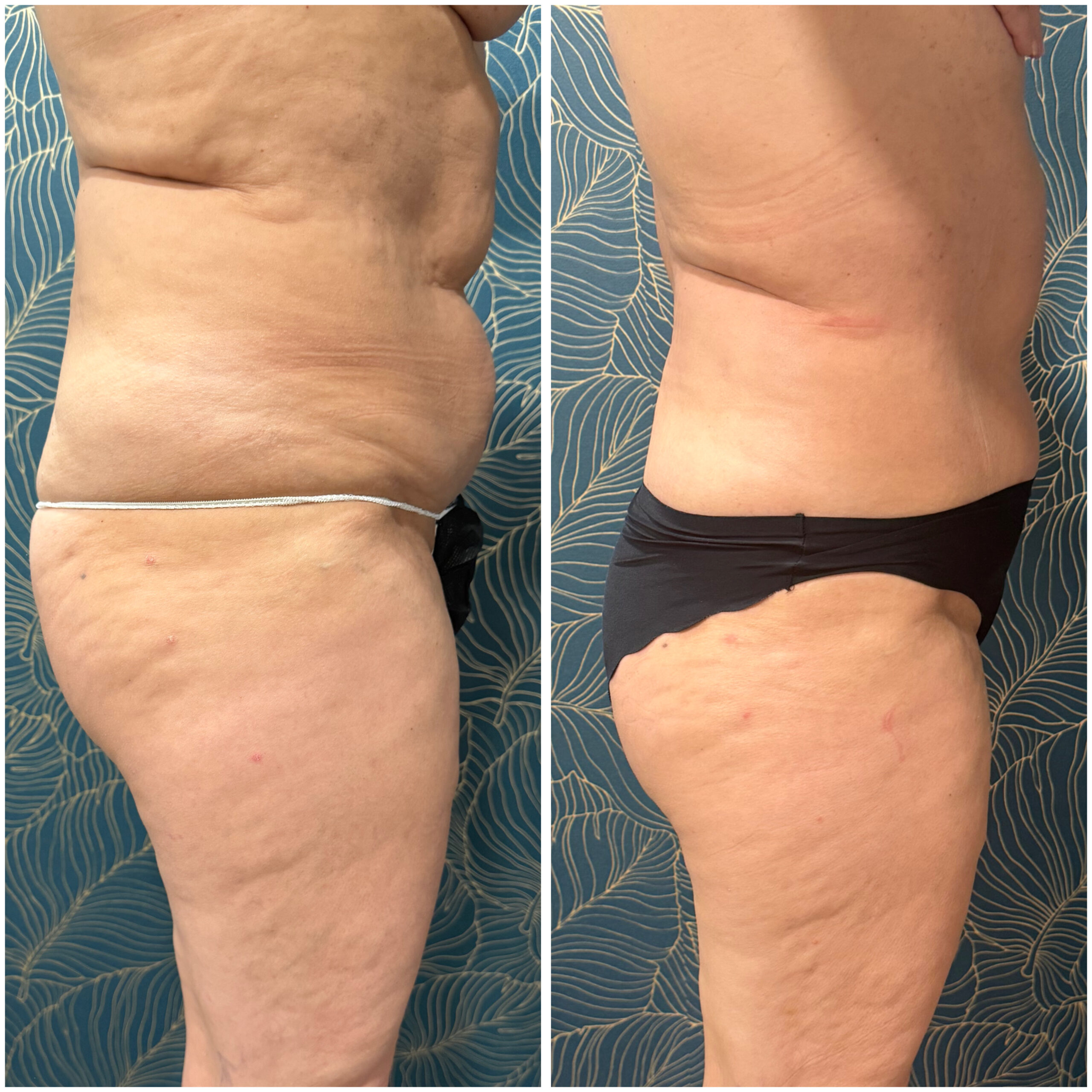 CA83C630-95B7-4761-80C9-0546AEDEBB2F